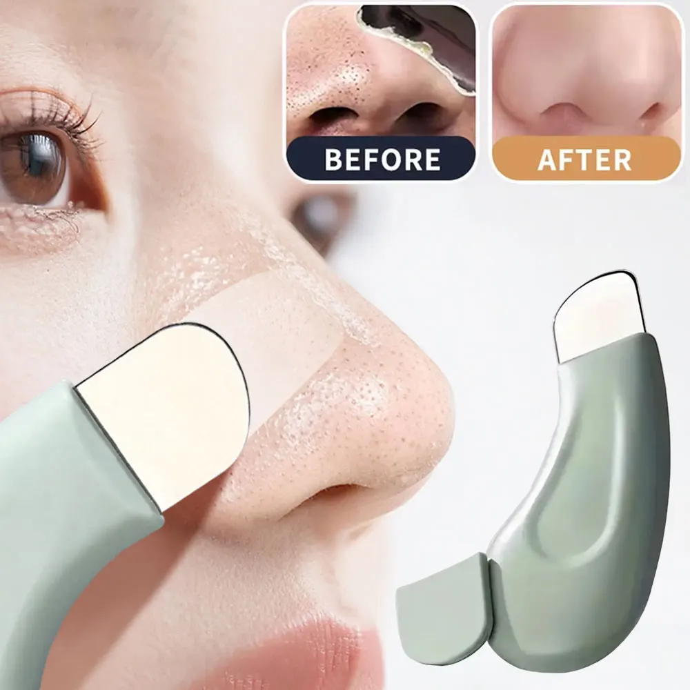Nasal Aspirator - 毛穴の黒ずみ除去ツール、深層クレンジング用フェイススパチュラ、鼻の白ニキビ除去器、肌の毛穴クレンジング用スキンケア美容ツール